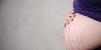 trudnoća i promene na koži